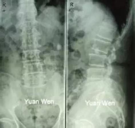牙科硬膜材的神奇调制:揭秘牙科修复的“秘密武器”(图1) 牙科硬膜材的神奇调制:揭秘牙科修复的“秘密武器”(图1)