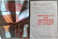 骨科灵保健液——骨病患者及心脑血管患者的“福音”